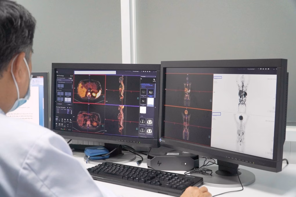 Chụp PET/CT tại Bệnh viện Chợ Rẫy Chụp PET/CT tại Bệnh viện Chợ Rẫy