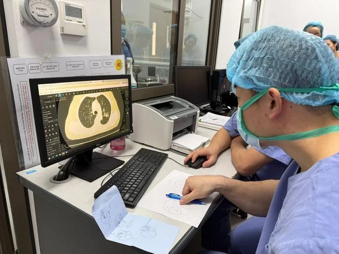 Đ&agrave;o tạo EBUS tại Bệnh viện 19‑8