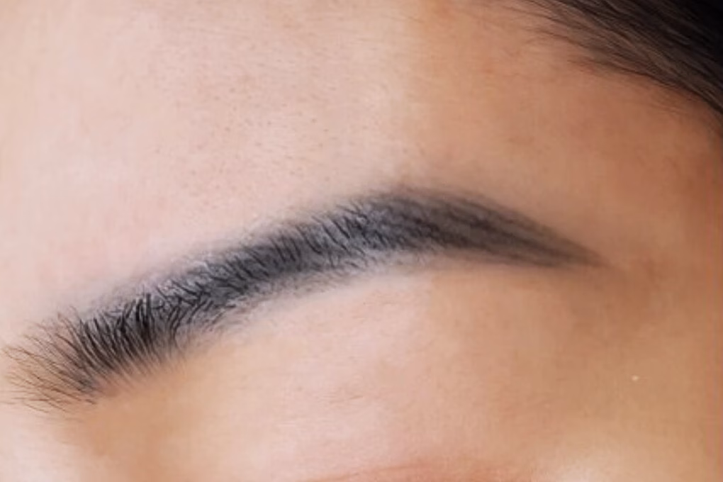 Bị ‘tatu’ kém chất lượng, một cô gái trẻ tìm đến xóa xăm bằng laser