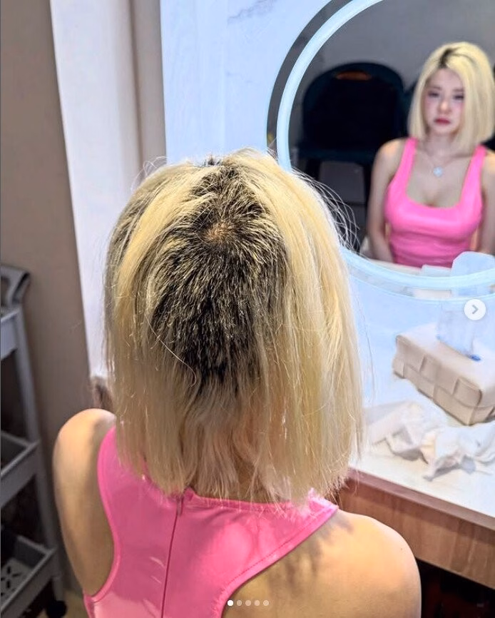 DJ Soda tâm sự về tình trạng tóc thưa: 10% tóc còn lại gây sốc