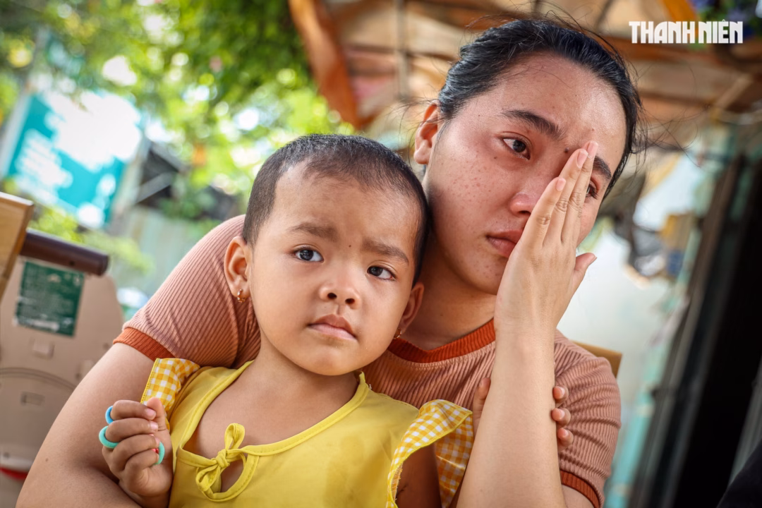 Cứu sống cháu bé 4 tuổi nguy cơ bị mù vì ung thư mắt