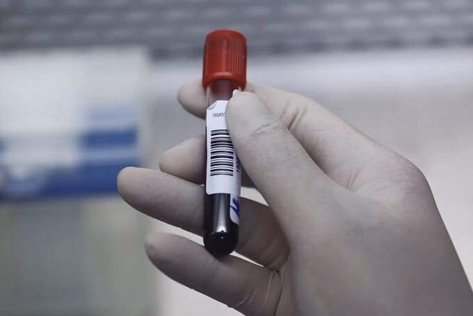 Người Việt dễ mắc bệnh mỡ máu cao vì thói quen ăn uống không lành mạnh