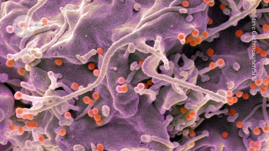 Vaccine HIV sử dụng mRNA tạo phản ứng miễn dịch mạnh ở người thử nghiệm