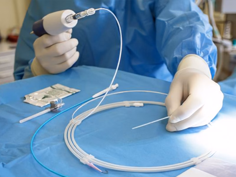 Keo sinh học điều trị suy giãn tĩnh mạch Keo sinh học điều trị suy giãn tĩnh mạch