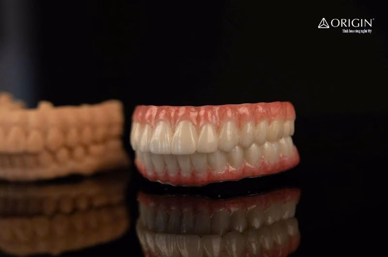Phục h&igrave;nh implant to&agrave;n h&agrave;m bằng Origin Zirconia &ndash; độ trong suốt tự nhi&ecirc;n