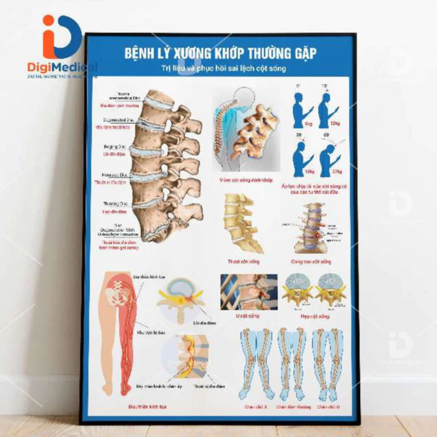 Làm thế nào decal dán tranh xương khớp có thể thay đổi góc nhìn về sức khỏe của bạn?