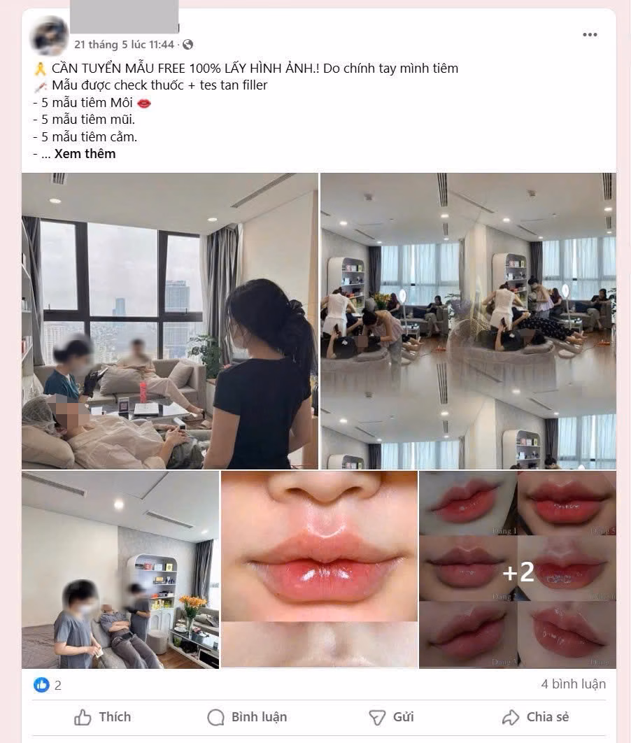 Spa thực hiện tiêm filler tùy tiện
