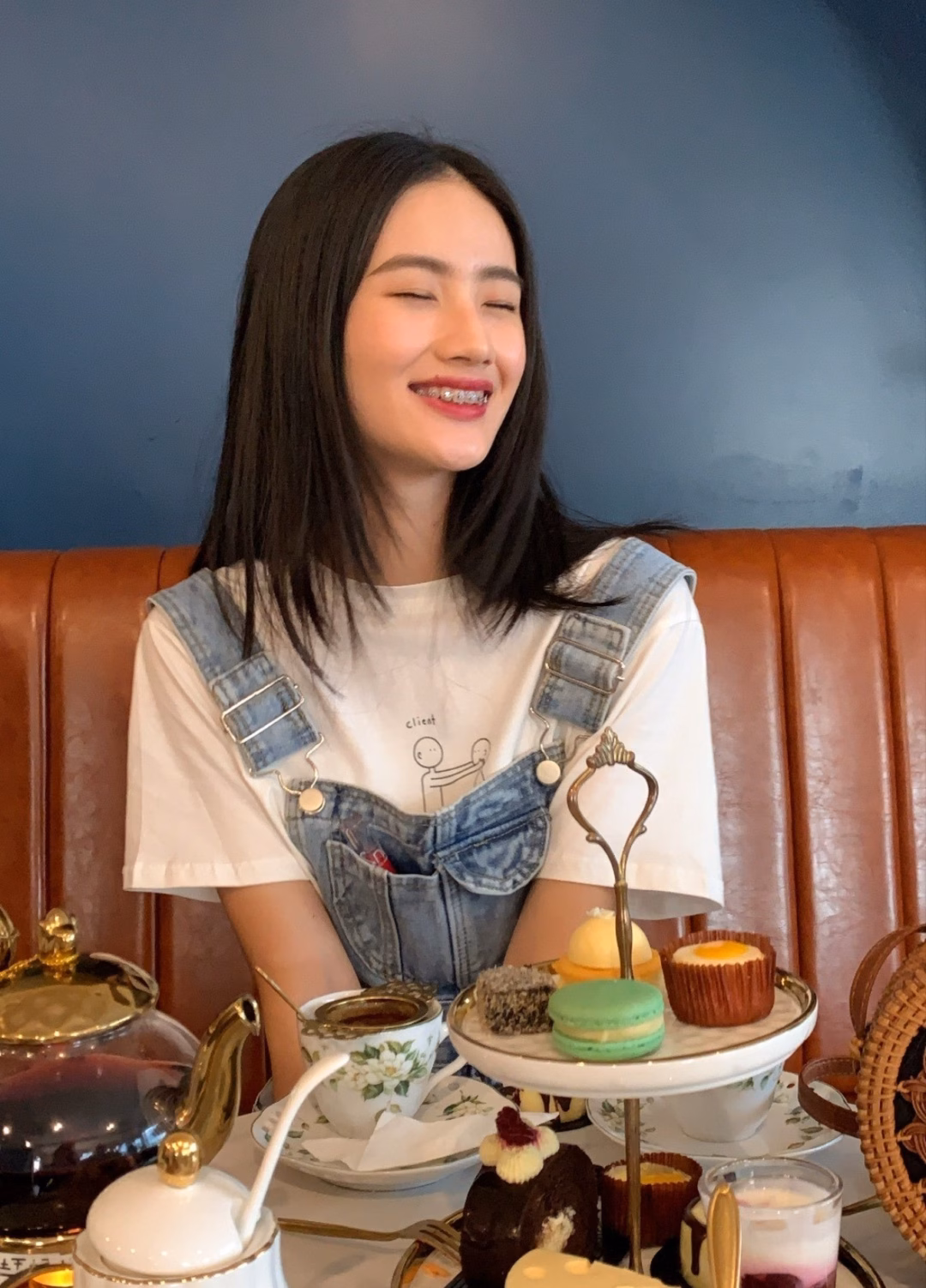 Hoa hậu Ý Nhi trước và sau niềng răng Hoa hậu Ý Nhi trước và sau niềng răng
