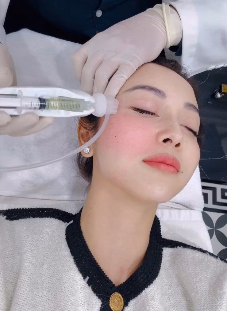 Quy trình tiêm tế bào gốc Quy trình tiêm tế bào gốc