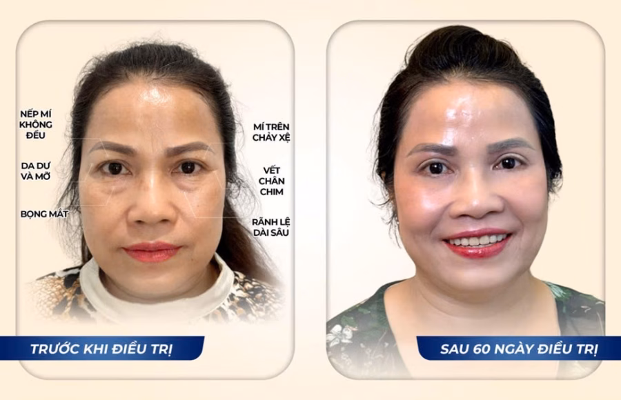 Chị Hồng Phương sau điều trị