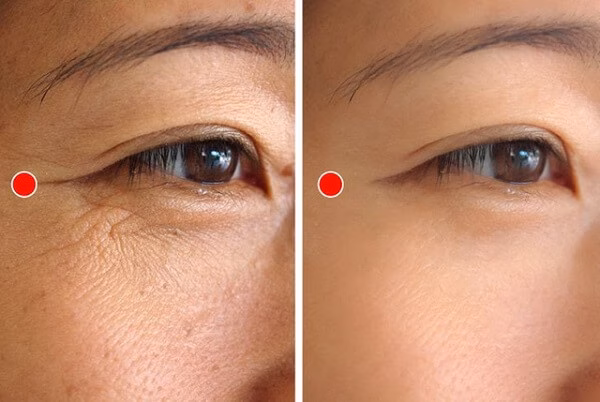 5 động tác đơn giản giúp xóa mờ nếp nhăn đuôi mắt 5 động tác đơn giản giúp xóa mờ nếp nhăn đuôi mắt