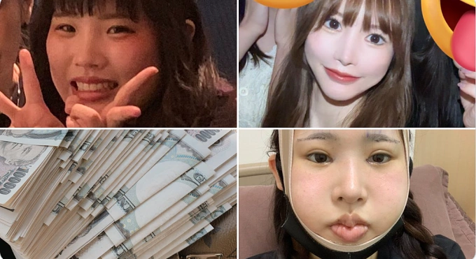 Rara chia sẻ h&agrave;nh tr&igrave;nh t&iacute;ch g&oacute;p tiền v&agrave; tự m&igrave;nh sang H&agrave;n Quốc thay đổi ngoại h&igrave;nh