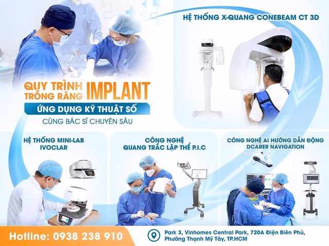 Công nghệ số trong trồng răng Implant: Giảm đau, nhanh chóng và thẩm mỹ Trồng răng Implant tại Dr. Care: Công nghệ giúp khách hàng không còn sợ đau- Ảnh 3.
