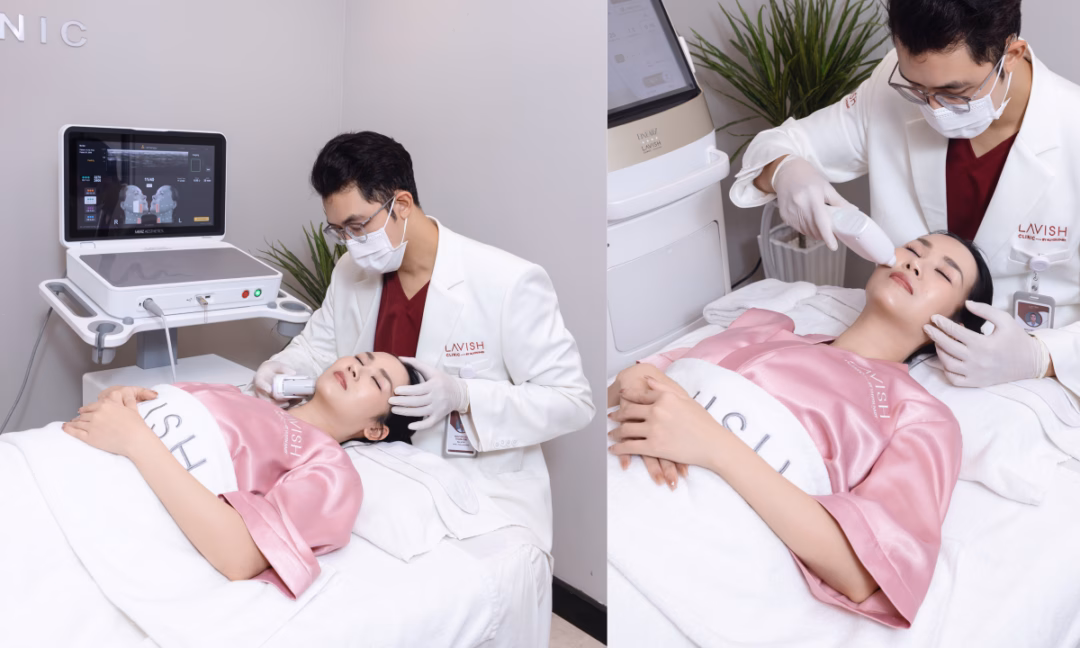 Võ Hạ Trâm bật mí bí quyết phục hồi da sau sinh bằng tái cấu trúc da đa tầng Công nghệ Ultherapy Prime Maxpro 2025 - Mini Ultherapy tác động đến lớp SMAS - cấu trúc nâng đỡ dưới da, cải thiện chảy xệ và định hình đường nét tự nhiên, không "đơ".