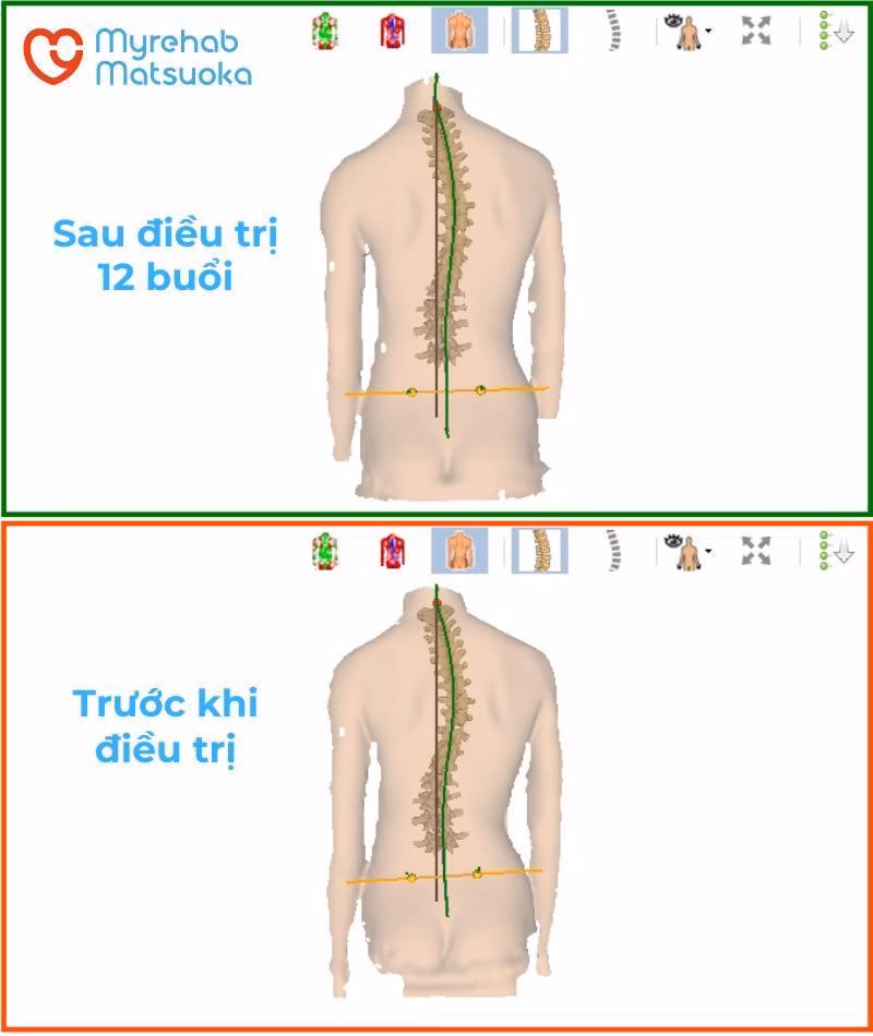 Hình ảnh 3D chụp từ máy 4D DIERS