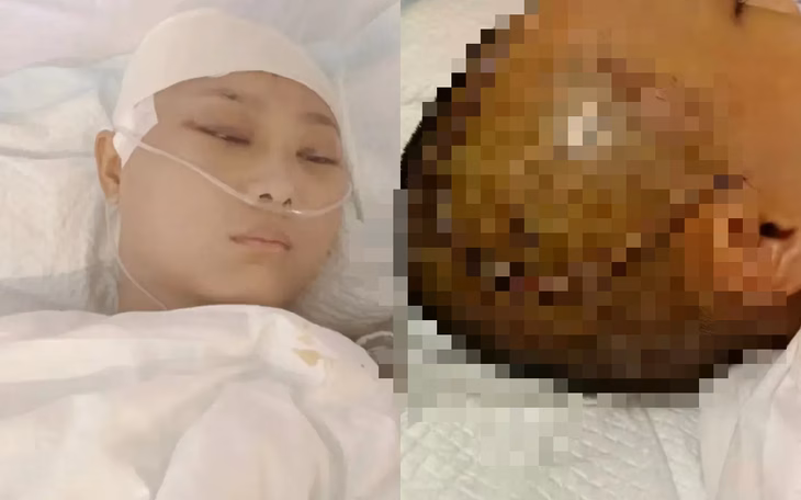 Nữ diễn viên đóng thế trải qua 10 tháng trên giường bệnh chỉ vì sự bất cẩn của đoàn phim Giang hồ dạ vũ thập niên đăng - Ảnh: SOHU