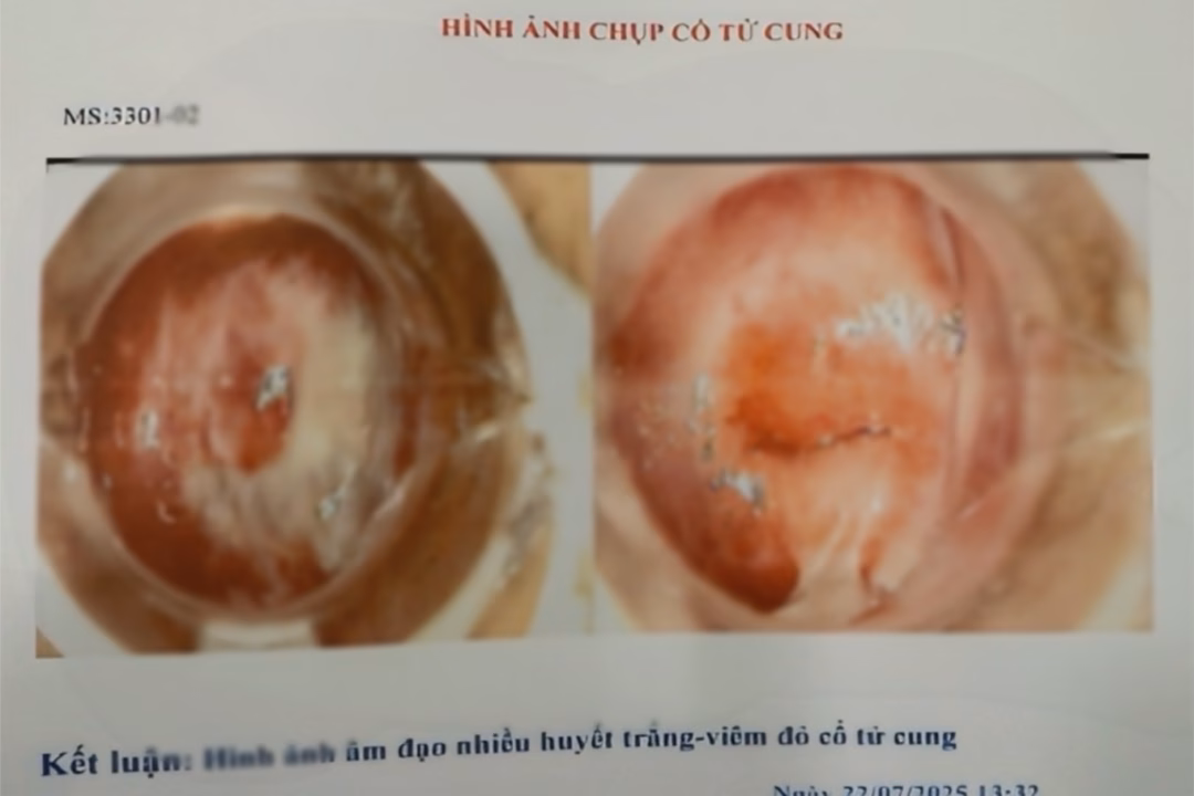 Hàng trăm hình ảnh chụp cổ tử cung bệnh lý có sẵn trong máy tính của bác sĩ D. tại phòng khám (Ảnh: SYT).