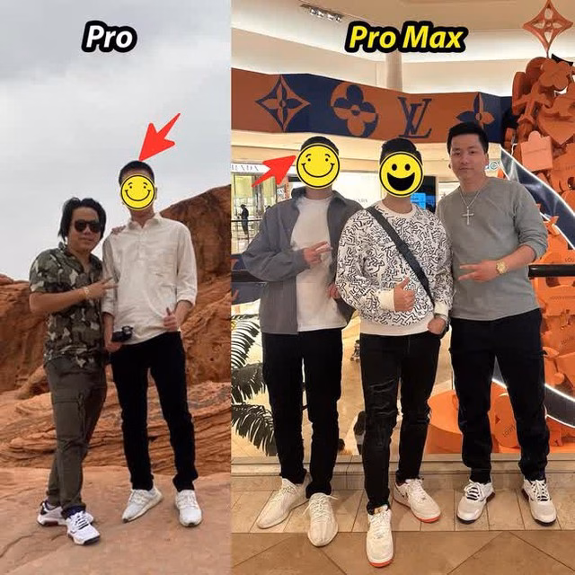 YouTuber Khoa Pug chi 3 tỷ đồng kéo chân, tăng 10cm chiều cao Khoa Pug từng tự hào khoe bản thân là phiên bản "Pro Max" sau khi kéo chân.