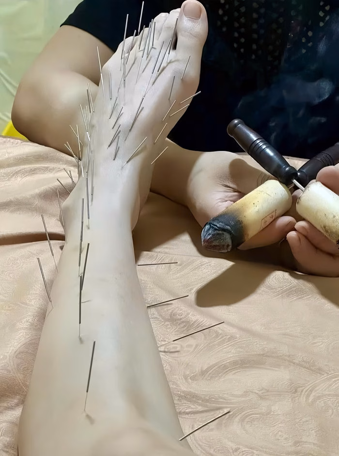 Trần Kiều Ân Trần Kiều Ân sau liệu pháp làm đẹp