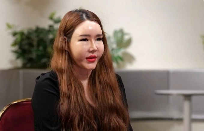 Nữ người mẫu chuyển giới A chia sẻ về nỗi ám ảnh phẫu thuật thẩm mỹ trong chương trình