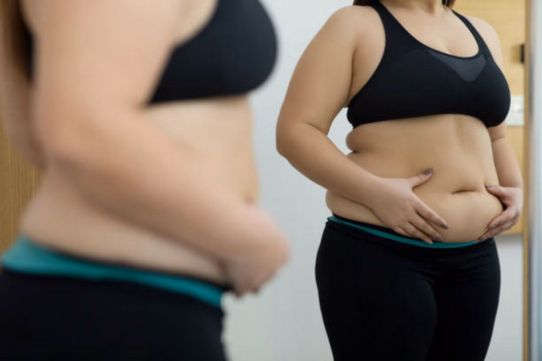 Mỡ bụng Mỡ bụng gây ra nhiều hệ lụy về sức khỏe.