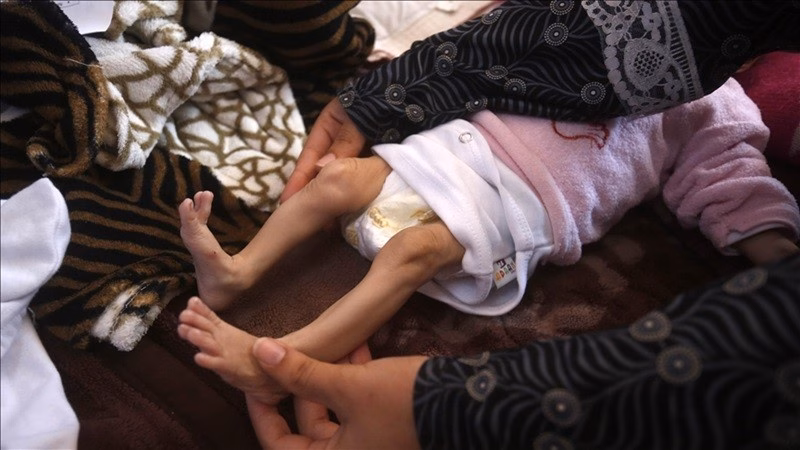 Thảm họa đói kém ở Gaza: Trẻ em Palestine thiệt mạng vì suy dinh dưỡng nghiêm trọng Đột nhiên tôi cảm thấy bé ngừng cử động và ngừng thở; cơ thể bé trở nên nặng nề hơn. Tôi không biết phải nói gì nữa. Bao nhiêu đứa trẻ vô tội như Zeinab phải chết đói để thế giới thức tỉnh?”, cô Abu Halib nói.