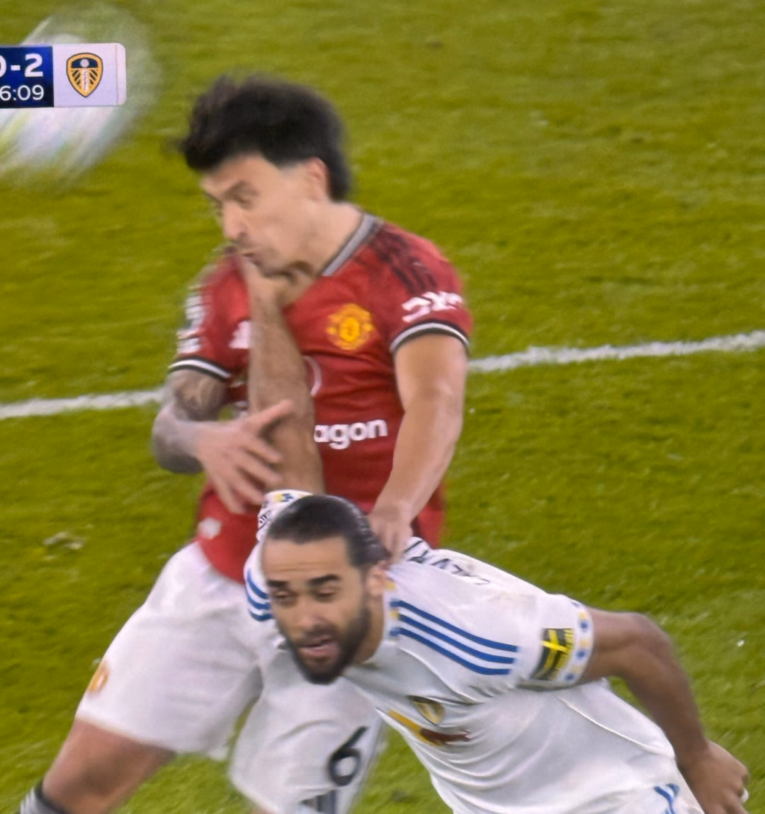 Cận cảnh tình huống Lisandro Martinez kéo tóc Calvert-Lewin khi tranh bóng bổng