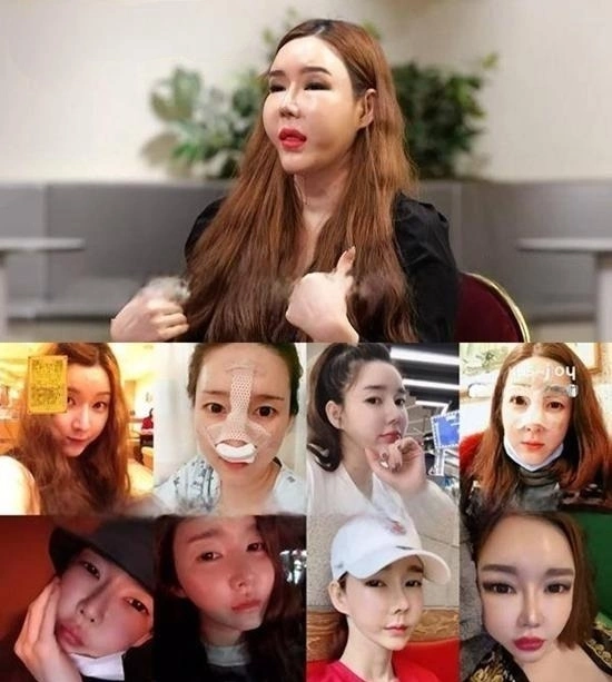 Hình ảnh thay đổi diện mạo của người mẫu chuyển giới A qua các năm